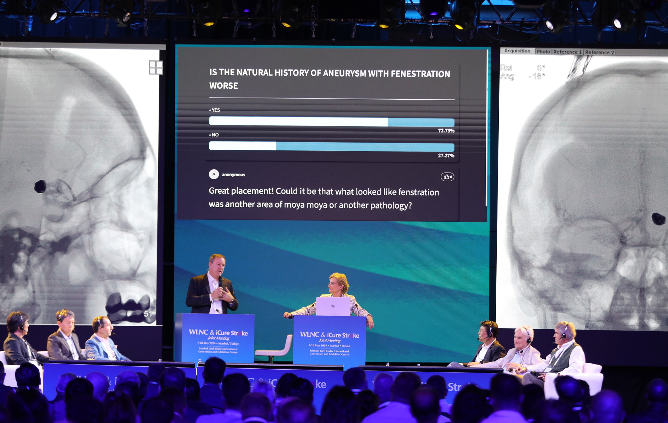 Live voting results displayed on screen during WLNC 2024, showing audience responses to a clinical question about aneurysm fenestration, with real-time Q&A from participants.