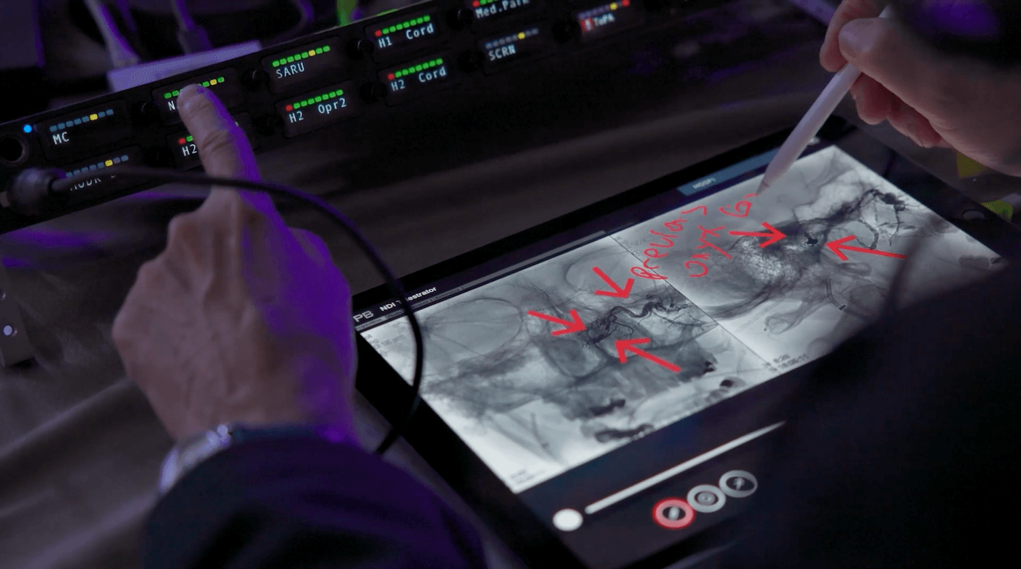 lose-up of custom telestrator interface at WLNC 2024, with a moderator using a digital pen to annotate angiographic brain scans in real time